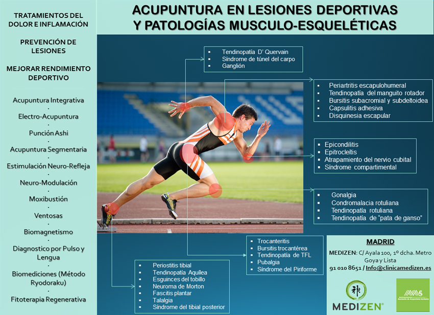 Curso de Acupuntura en Lesiones Deportivas y Patologías Musculo-Esqueléticas. Febrero 2019