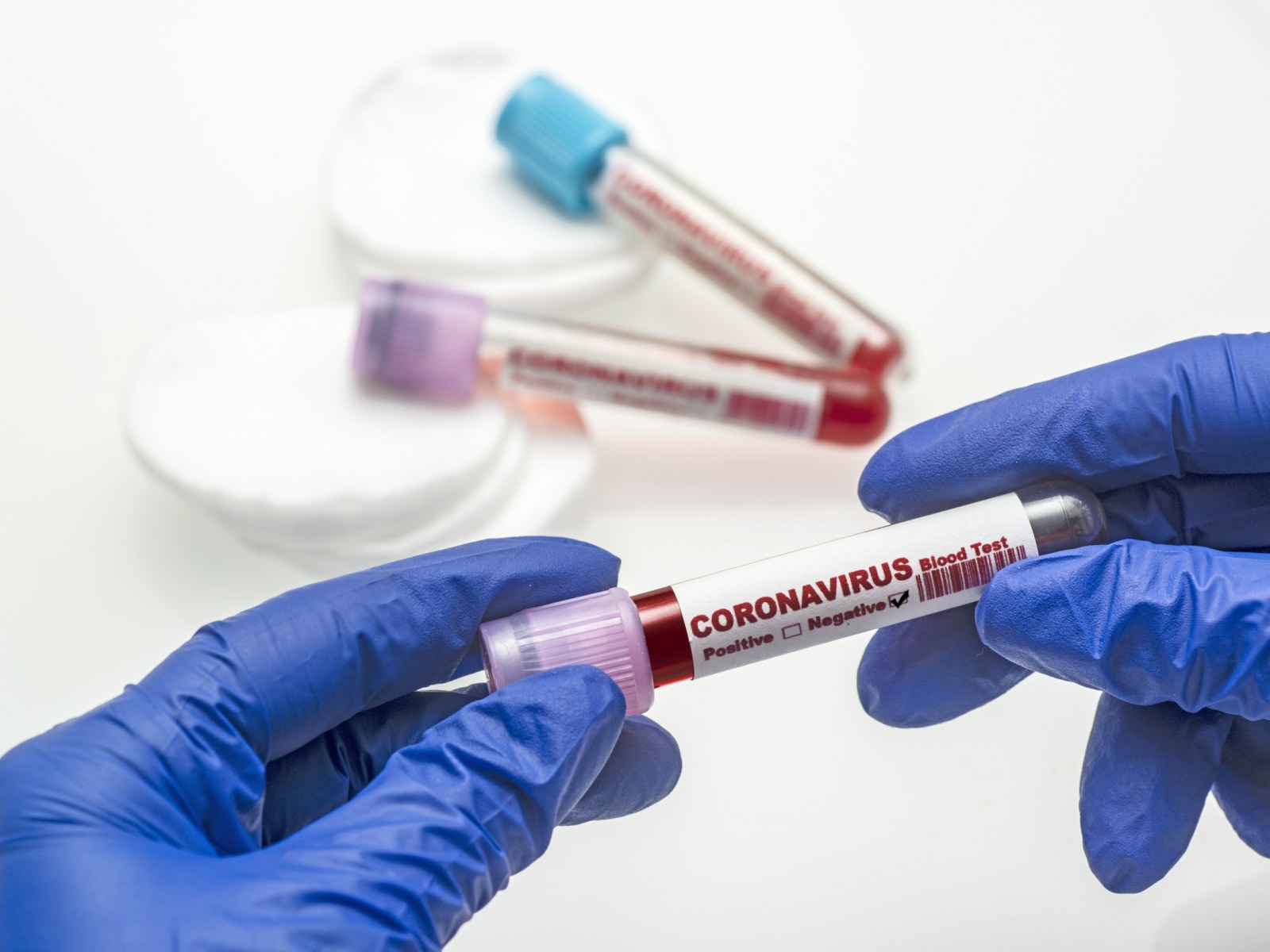 Técnicas para el diagnóstico del nuevo coronavirus Covid-19