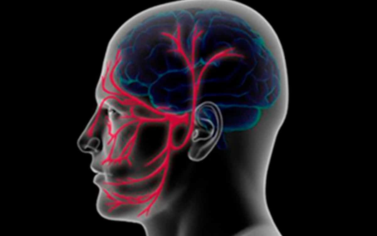 Eficacia y seguridad de la acupuntura en el tratamiento de la Neuralgia del Trigémino