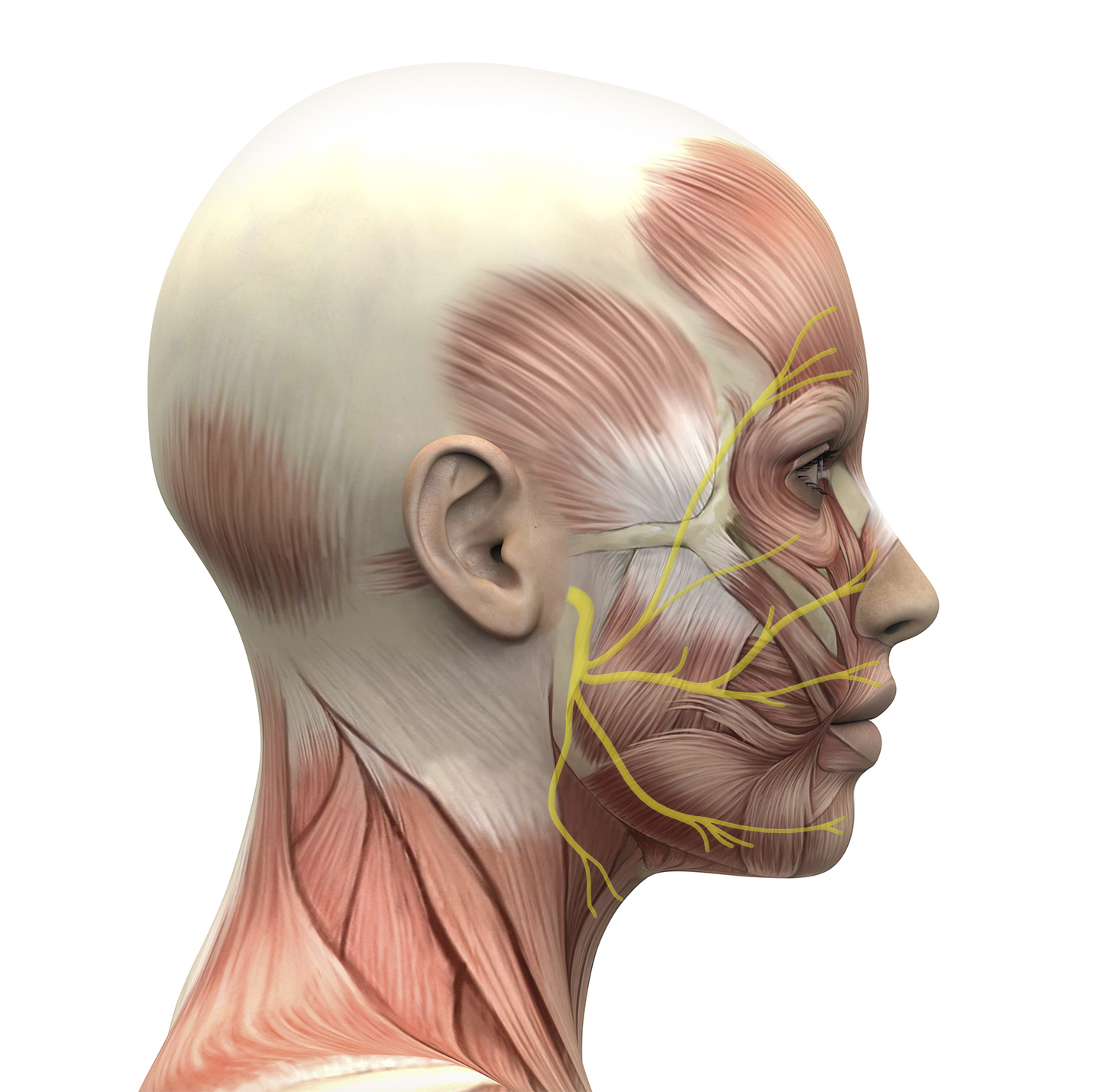 Eficacia de la acupuntura en la Parálisis Facial Periférica