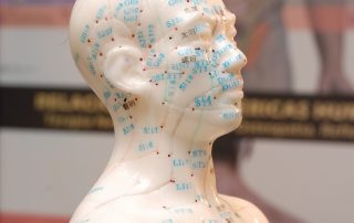 Mejores centros de acupuntura en Madrid