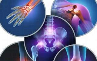 Eficacia clínica la acupuntura en el tratamiento de la artritis reumatoide: revisión sistemática y metanálisis