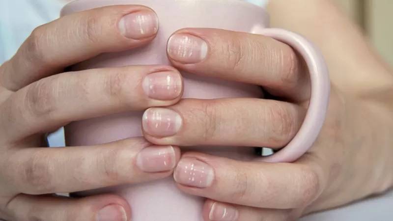 ¿Qué nos dicen las uñas? - Análisis desde la Medicina Tradicional China (parte 2)