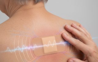 Parche de capsaicina 179 mg: el estudio CASPAR y el alivio progresivo del dolor neuropático