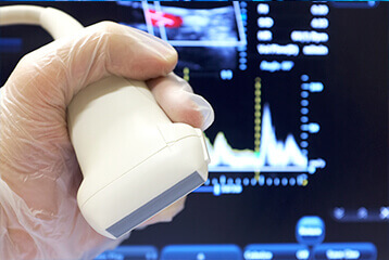 Jeringa de microespuma utilizada en el tratamiento de varices en Clínica Medizen