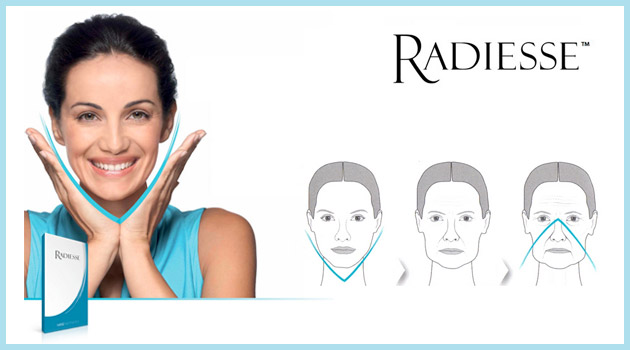 Radiesse: bioestimulación de colágeno con efecto lifting sin cirugía