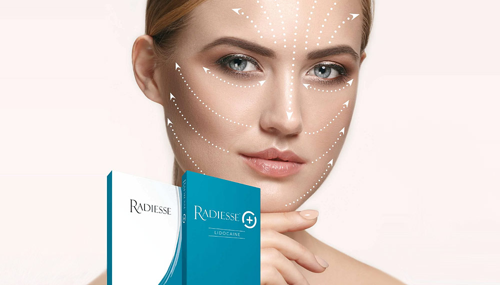 Radiesse: bioestimulación de colágeno con efecto lifting sin cirugía