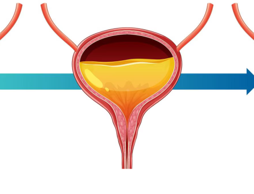 Incontinencia urinaria: por qué los ejercicios de Kegel no bastan
